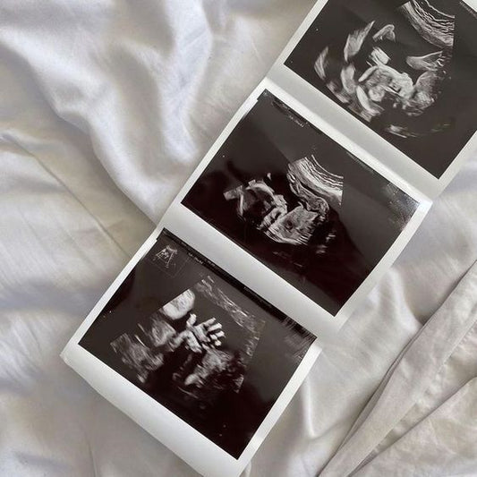 ¿Por qué prepararte antes del embarazo cambia todo?